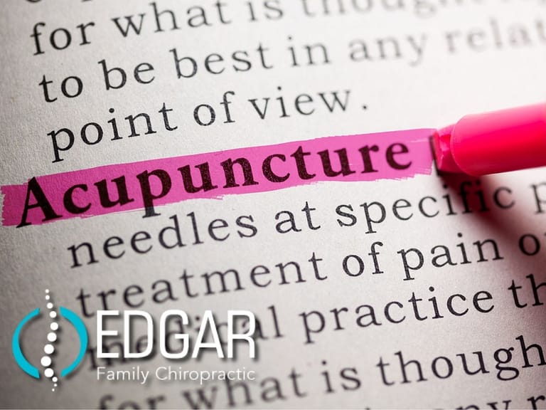 Acupuncture